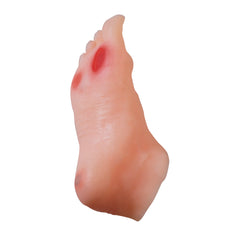 Diabetic foot Wound Model