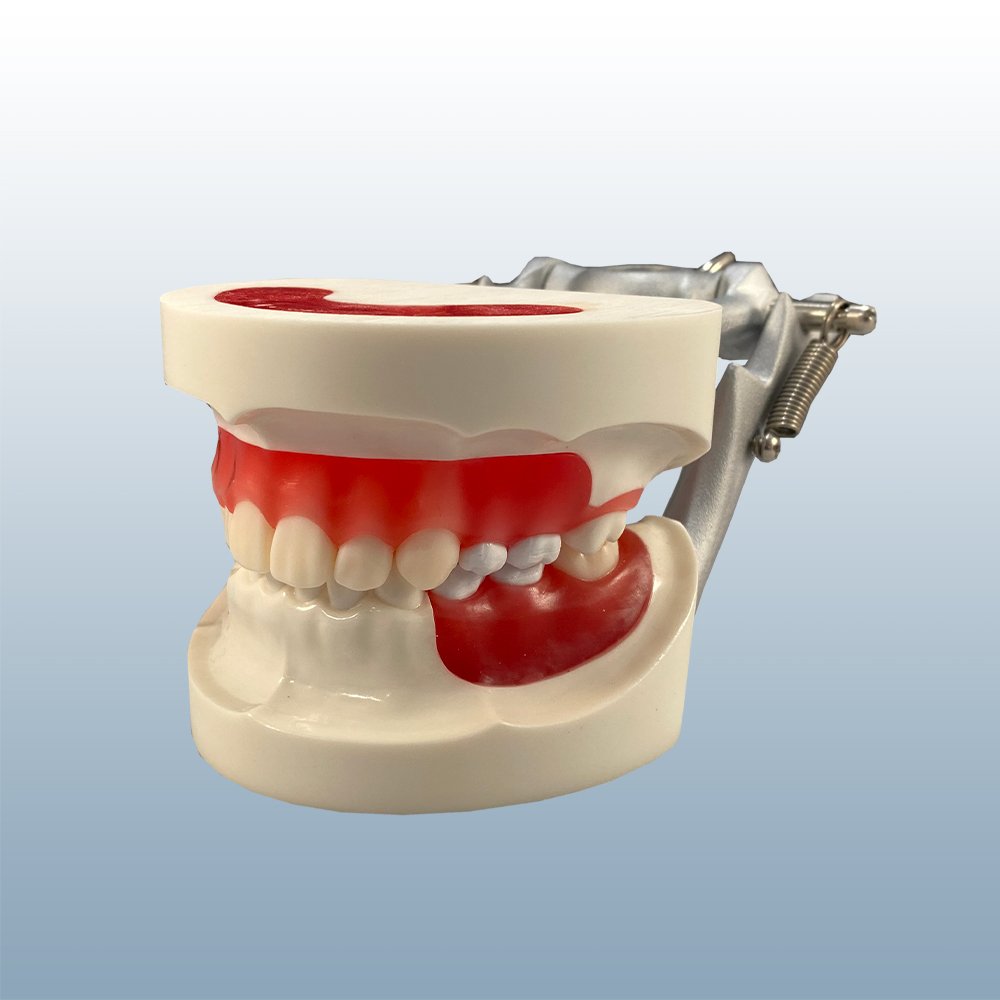 Orthodontic Brackets Installation Model Buyamag – Buyamag INC