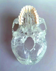 dental clear skull Maxillary Teeth Sinuses