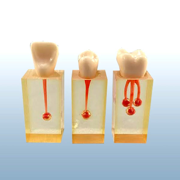 ensodontic teeth surgical model