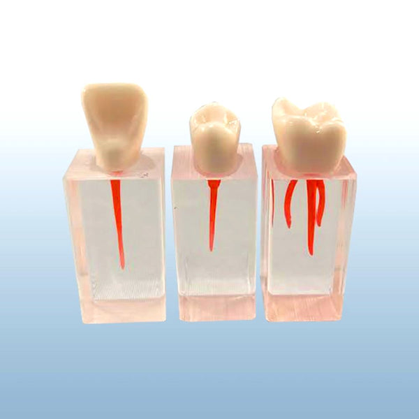 endodontic root canal model