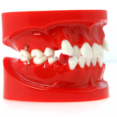 orthodontic training models