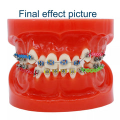 orthodontic practice models