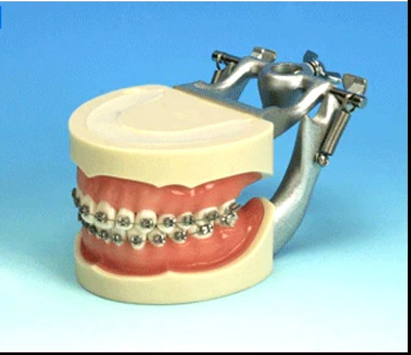 orthodontic model