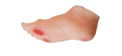 Diabetic Neuropathy Pressure Ulcer Foot Wound Model Skin Sore