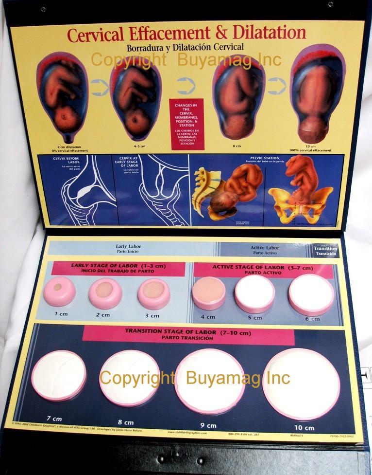 Cervical Effacement Dilation Display Model-Buyamag – Buyamag INC