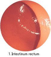 Replacement Semi-Difficult Intestine