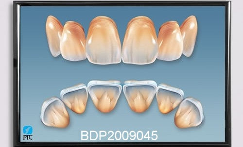 Dental Poster Anterior Teeth Anatomy – Buyamag INC