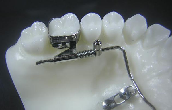 Temporary Anchorage Devices Tad Orthodontic Model 1 Buyamag Inc